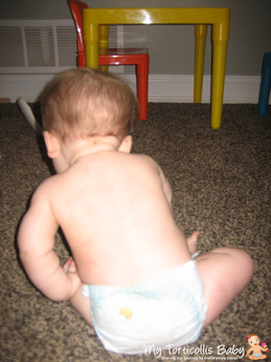 Baby with right torticollis tilting her trunk to her left side.