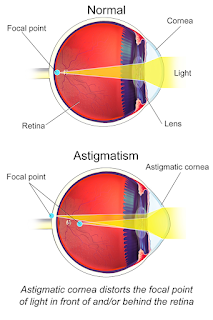 Astigmat çizimi