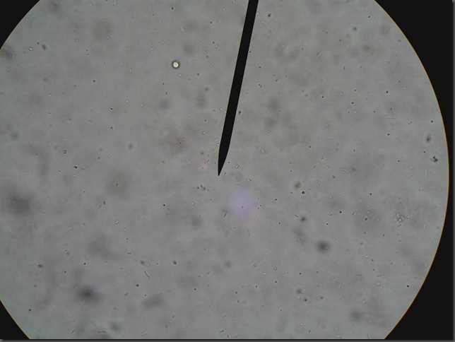 yogurt bacteria 400x