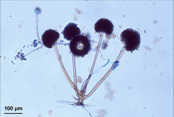 MIKROBIOLOGI Dengan berkembangnya teknologi pangan 