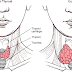 Nursing Care Plan for Goiter - Assessment and Diagnosis