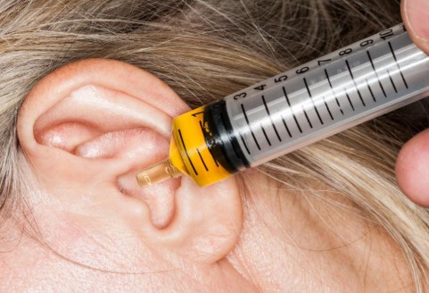 The Easiest Method To Clean Your Ears Naturally #health