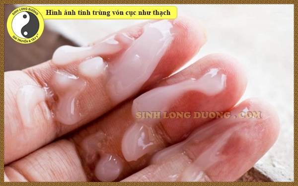 Tôi đã chữa khỏi tinh trùng vón cục như thạch bằng cách này