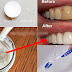 How To Whiten Teeth Just 2 Minutes