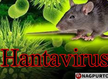 Hantavirus news: 6 things you should know about Hantavirus pulmonary syndrome