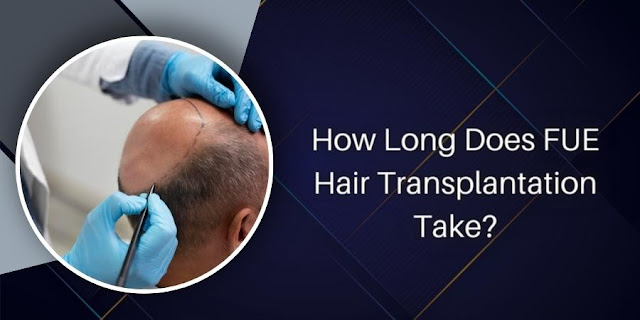 How Long Does FUE Hair Transplantation Take