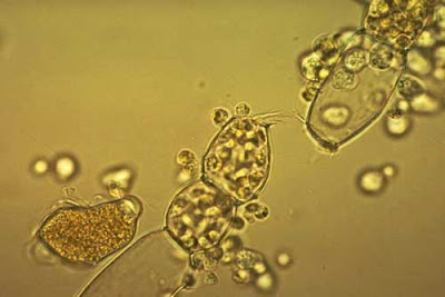 Chytridiomycota: Pengertian, Ciri, Struktur Tubuh, Contoh dan Peranannya