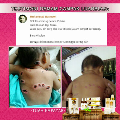 RCC Stevia Sweetner, gula semulajadi, sila sihat, dramaticuniq