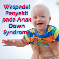 Kesehatan Anak Down Syndrome