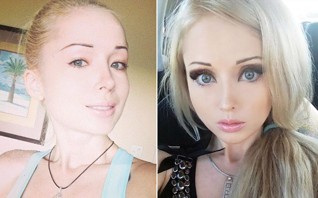 Veja fotos da Barbie Humana antes e depois das cirurgias plásticas 