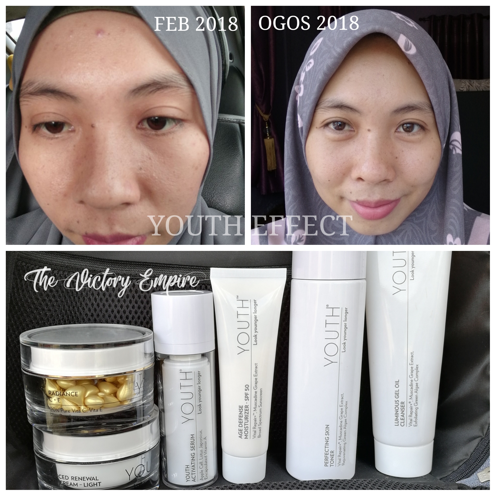 Testimoni Skincare Youth Shaklee