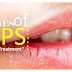 होठों के सूखने के कारण, लक्षण और बचाव