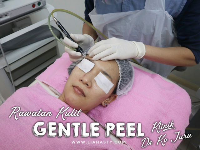 Rawatan Kulit GentlePeel di Klinik Pakar Kulit Dr Ko Juru