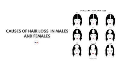 A detailed answering guide to 'does stress cause hair loss?
