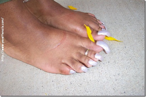 unhas-25
