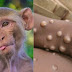 La OMS declara alerta máxima internacional por aumento casos viruela del mono.
