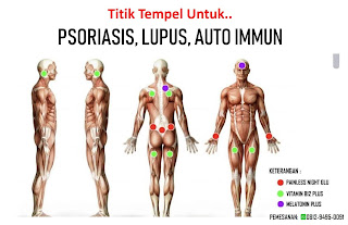 Peluang Bisnis Organik | Titik Tempel Koyo One More Untuk Psioriasis, Lupus, Auto Immun