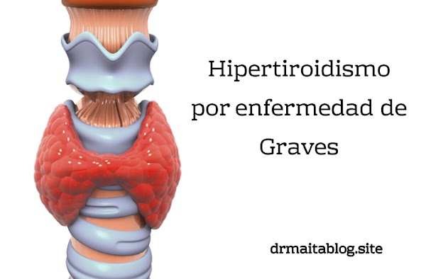 Hipertiroidismo por enfermedad de Graves