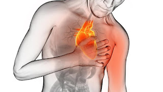 Doença Cardiovascular