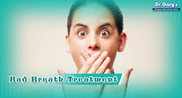 Bad Breath Treatment