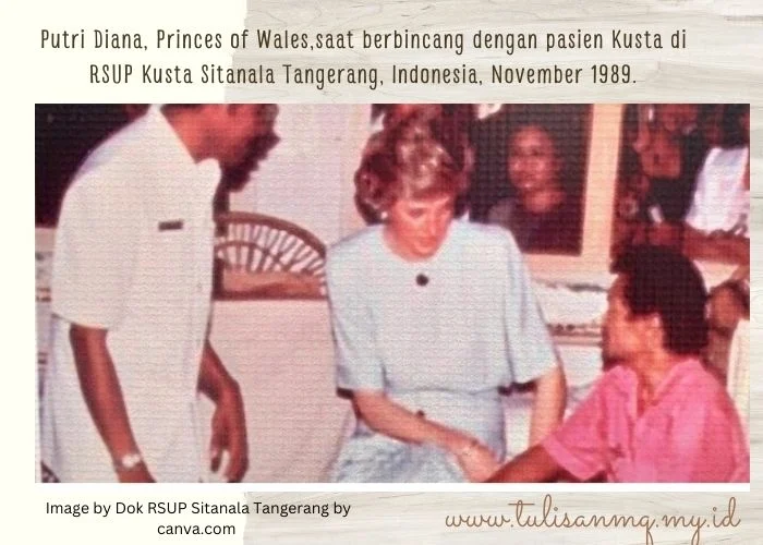 Lady Diana dan pasien kusta