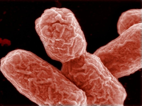 Gambar Bakteri E Coli
