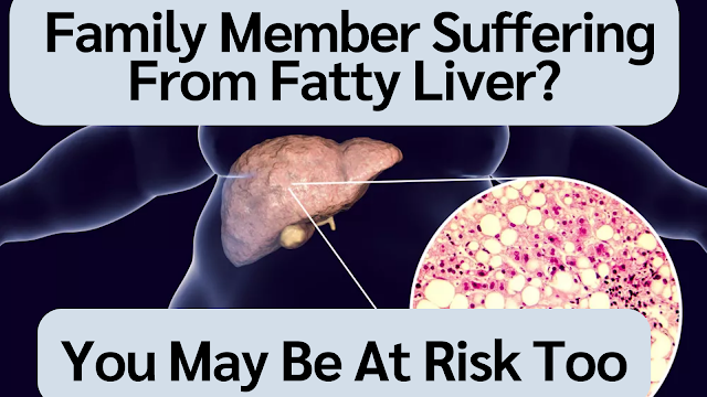 Family Member Suffering From Fatty Liver? You May Be At Risk Too