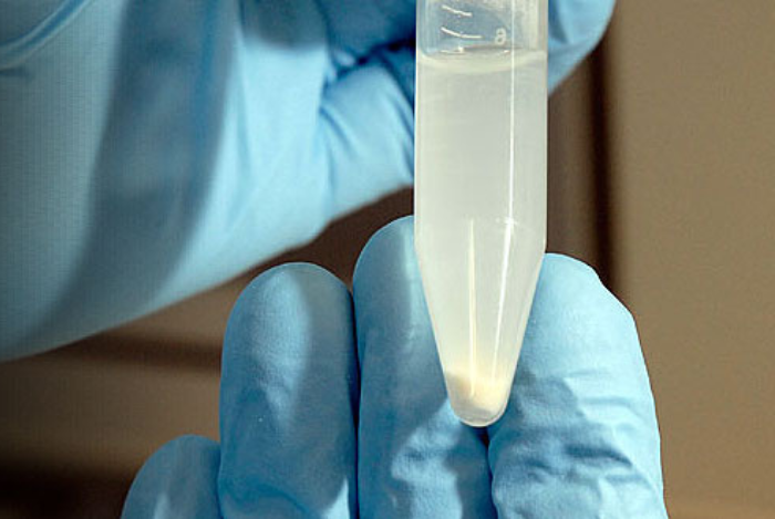 Mengenal Teknik Isolasi DNA Metode CTAB (Cethyl-Trimethyl-Ammonium-Bromide)