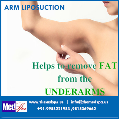 armliposuciton, armliposuctioncost, armliposuctionsurgery, armlipo, cosemticsurgeon, plasticsurgeon, cosmeticsurgery, #armliposuciton