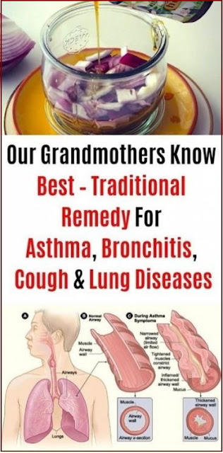 The Cure Our Grandmothers Use To Treat Asthma, Bronchitis, Coughing And Lung Problems