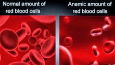 Anaemic Red Blood Cells