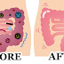 THIS 2 INGREDIENT REMEDY FLUSHES POUNDS OF WASTE FROM YOUR COLON