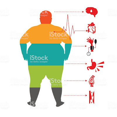obesity related  health problems
