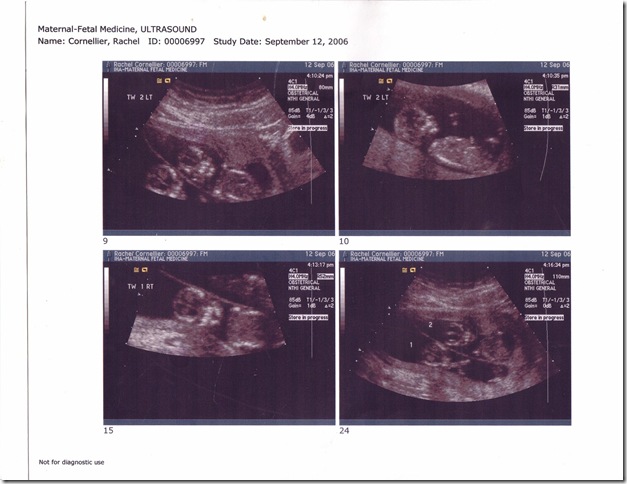Ultrasound4[1]