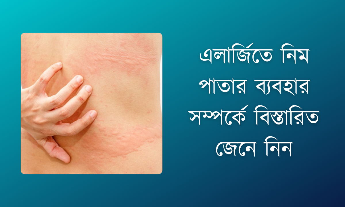 এলার্জিতে নিম পাতার ব্যবহার সম্পর্কে বিস্তারিত জেনে নিন