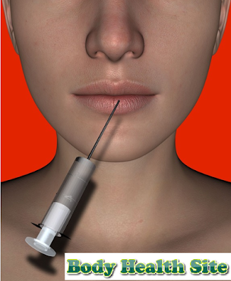 lip filler injection points, lip filler injection, lip filler injection techniques, filler injection, cheek filler injection sites, lip augmentation lip filler injection points, cheek filler injection points, eyebrow filler injection, chin filler injection points, breast filler injection, penis filler injection, dermal filler injection sites, best cannula for filler injection, filler injection before and after, labial filler injection before and after, dermal filler injection, breast filler injection cost, nose filler injection, pimple at filler injection site, filler injection sites, cheek filler injection technique, lip filler injection sites, eyelid filler injection cost, brow filler injection,