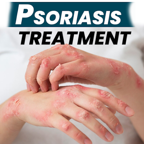 Homeopathic remedies for psoriasis