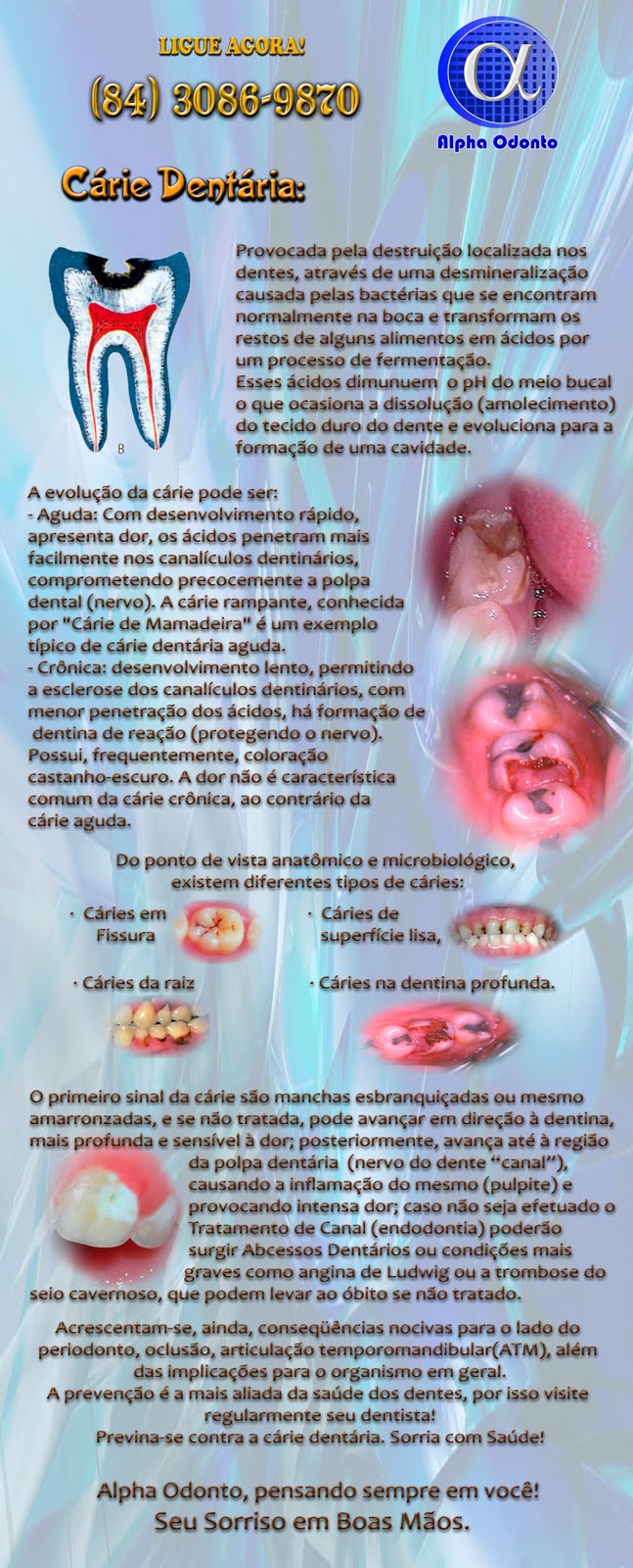 CÁRIE DENTAL