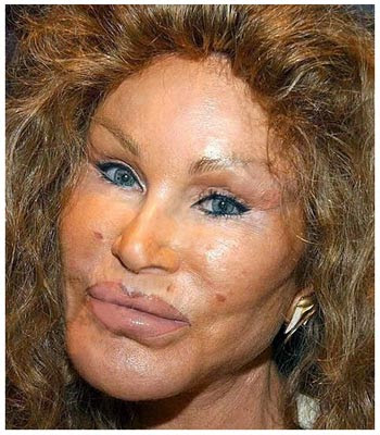 lady gaga before and after nose job. Joan Van Ark Bad Nose Job