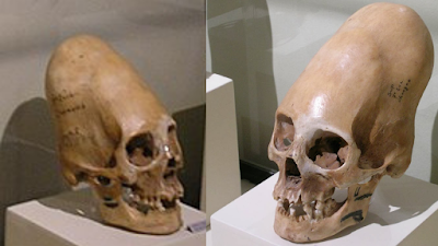 Really large elongated skulls from the ancient world.