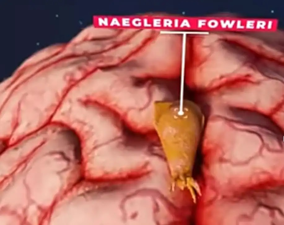Naegleria fowleri or brain eater amobea