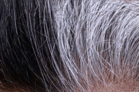 الشعر الرمادي قد يكون علامة لأمراض خطيرة