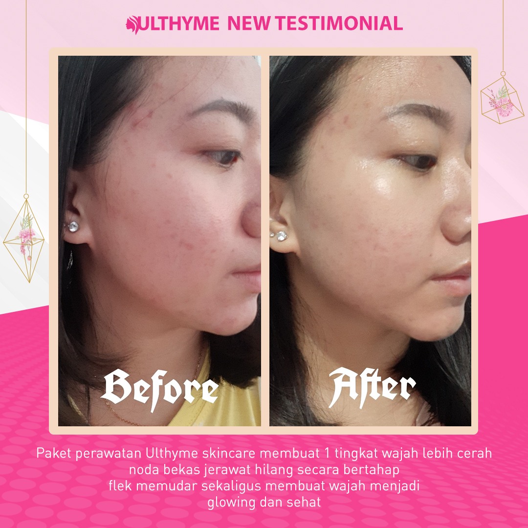 ulthyme skincare