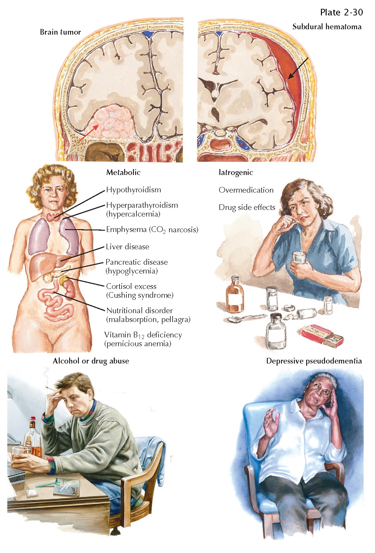 TREATABLE DEMENTIAS