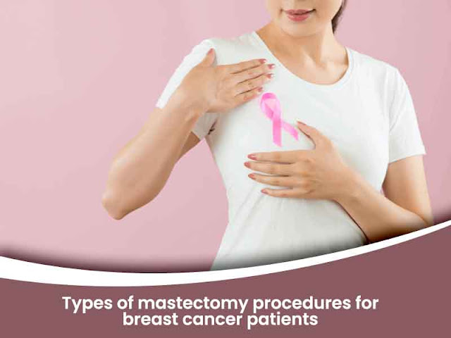 Breast Cancer Mastectomy Procedure