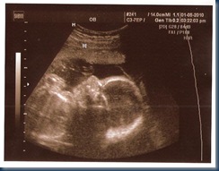 Baby_B_-_24_Weeks,_6_Days[1]