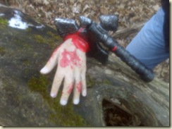 Severed Hand