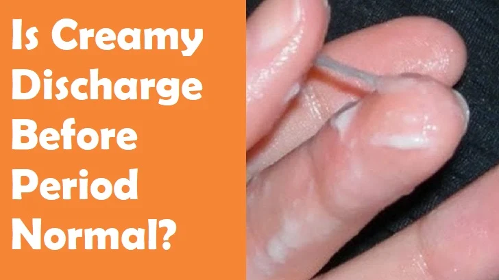 Is Creamy Discharge Before Period Normal? Find Out!