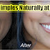 How to Get Dimples Naturally at home
