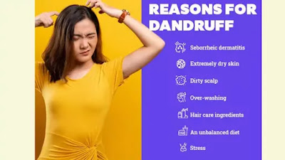 Dandruff and Hair loss